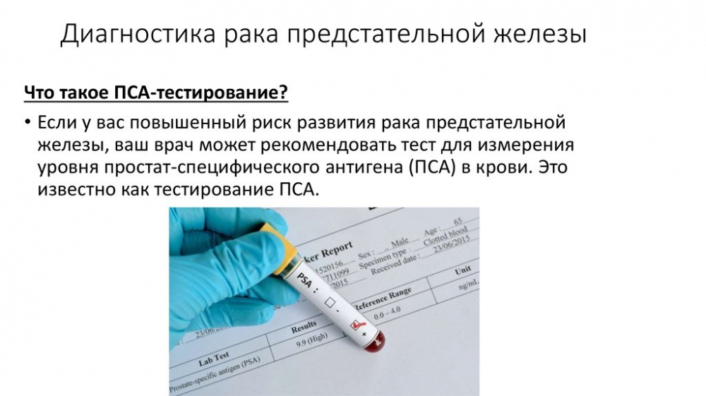 Онкоурология. Диагностика. Лечение - презентация онлайн